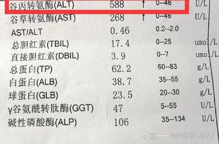事业单位体检谷丙转氨酶-图1