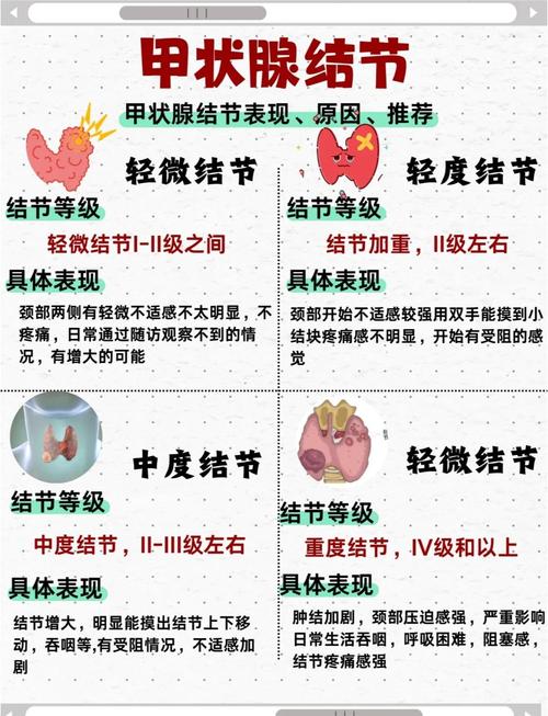 事业单位体检,甲状腺异常会影响录用吗?-图3 事业单位体检,甲状腺异常会影响录用吗?-图3